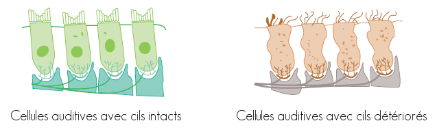 Cellules ciliées - Système auditif