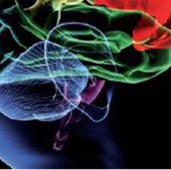 Zones du cerveau sont activées en cas d’acouphènes