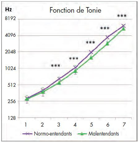 Apprendre à réentendre les sons aigus 1