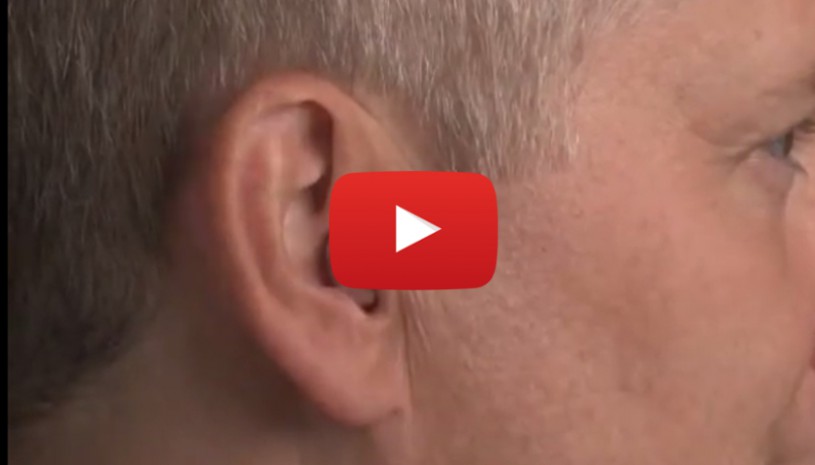 Vidéo sur comment insérer et retirer l'aide auditive intra semi profond