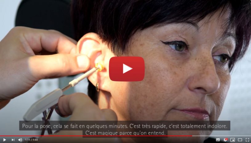 Vidéo "Colette raconte son expérience avec Lyric™" de la marque PHONAK