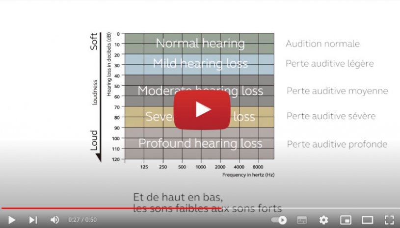 Vidéo "Degrés de perte auditive" de la marque RESOUND