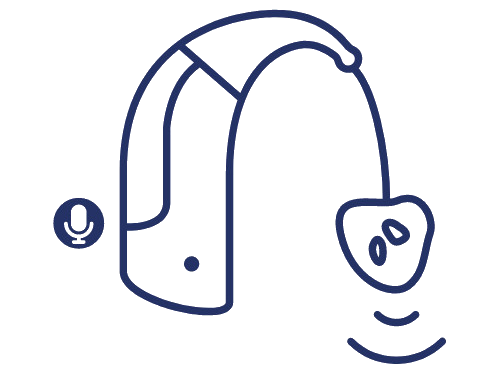 Prothèses auditives contour d'oreille chez Audition Conseil