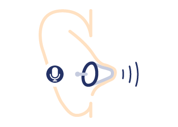 Aides auditives intra-auriculaires chez Audition Conseil